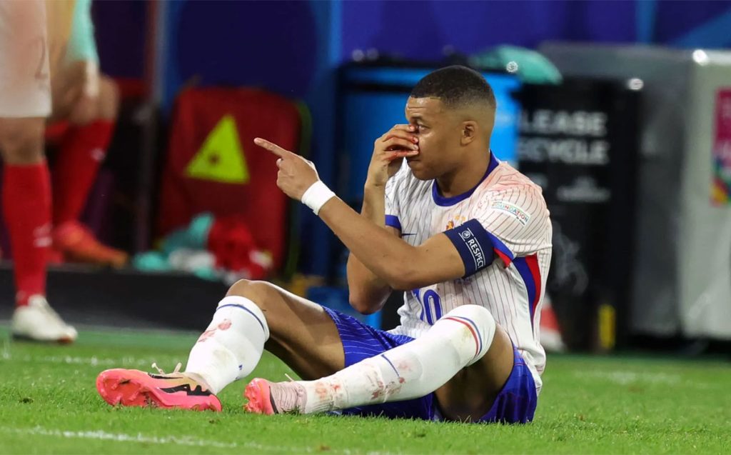 Francia reza por el regreso de Mbappé en la Eurocopa: “Vamos a ver cómo evoluciona”