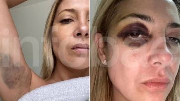 Revelan las fotos de Fabiola Yáñez agredida por Alberto Fernández