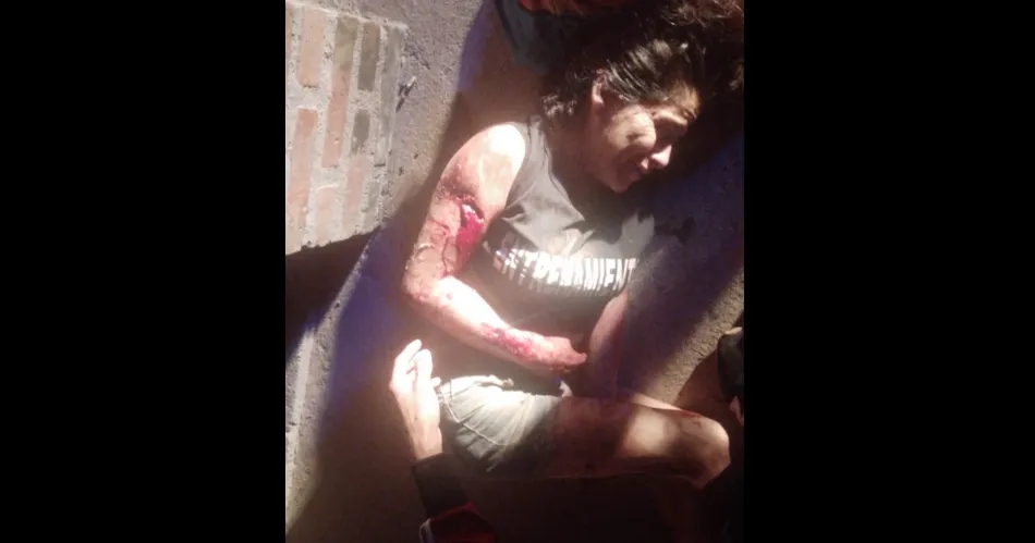Giro de 180° en el caso de la mujer mordida por dos perros en La Banda