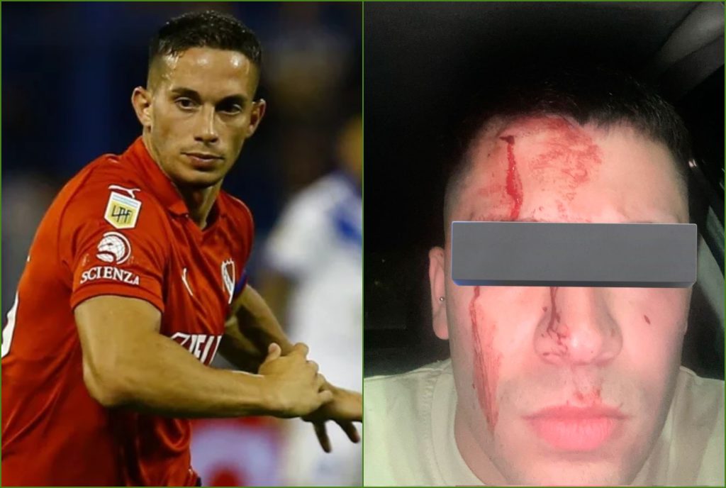 Así quedó el socio que denunció a Iván Marcone por la agresión