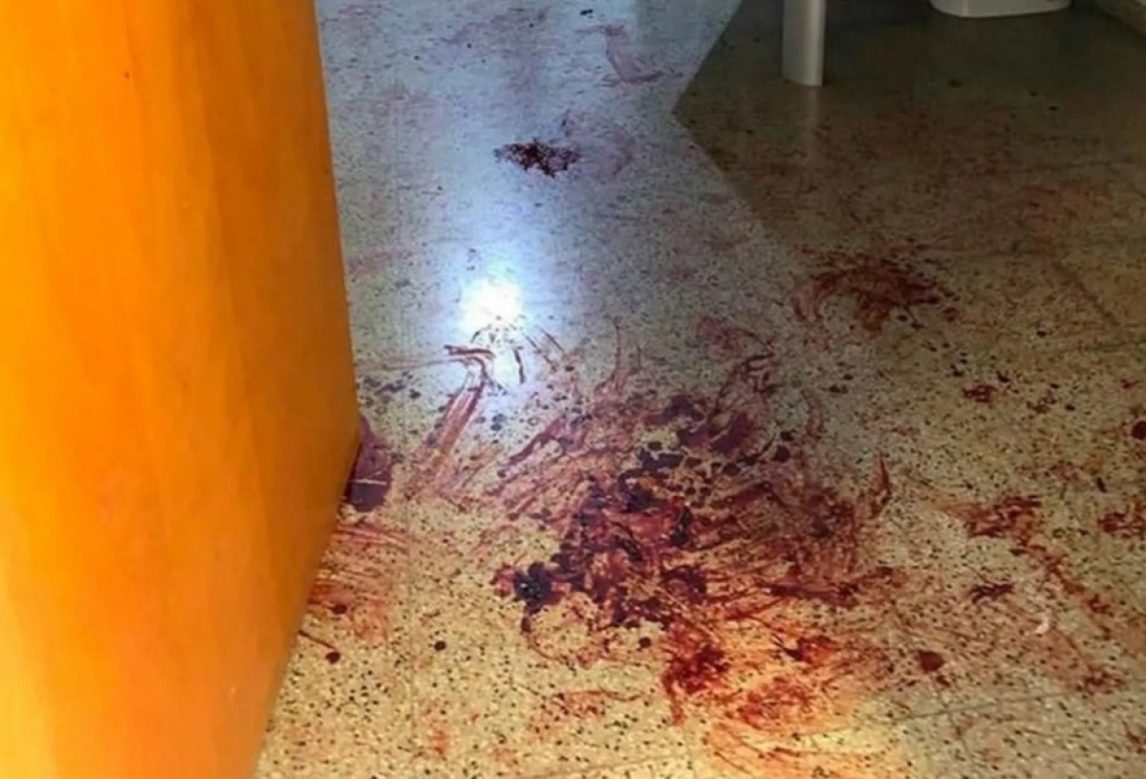 Terrible pelea entre dos hombres que compartían bebidas: uno fue atacado con un hierro y se defendió con una tijera