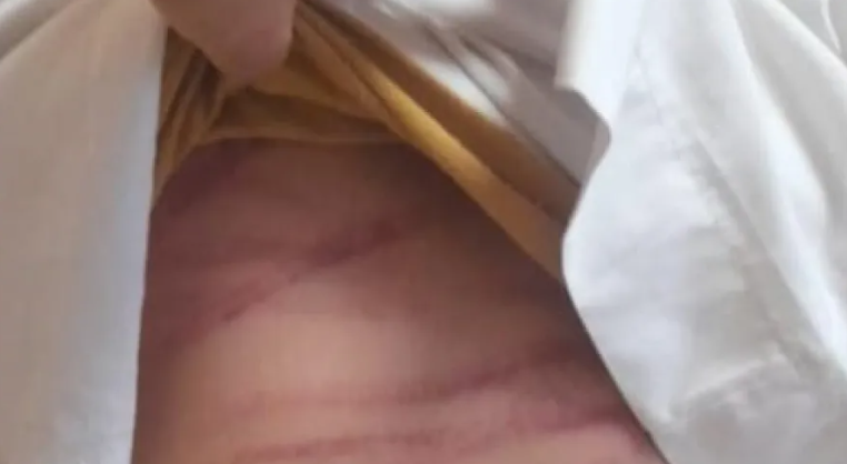 Una mujer denunció que su ahijado fue salvajemente atacado con un cable por su propia madre