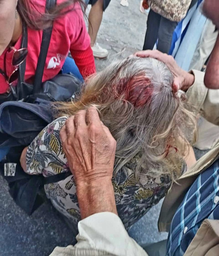 La policía derribó de un golpe a una jubilada en medio de la brutal represión