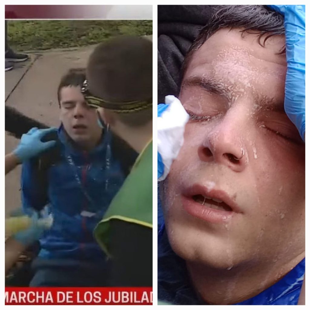 Gasearon al reportero gráfico que increpó a Santiago Caputo