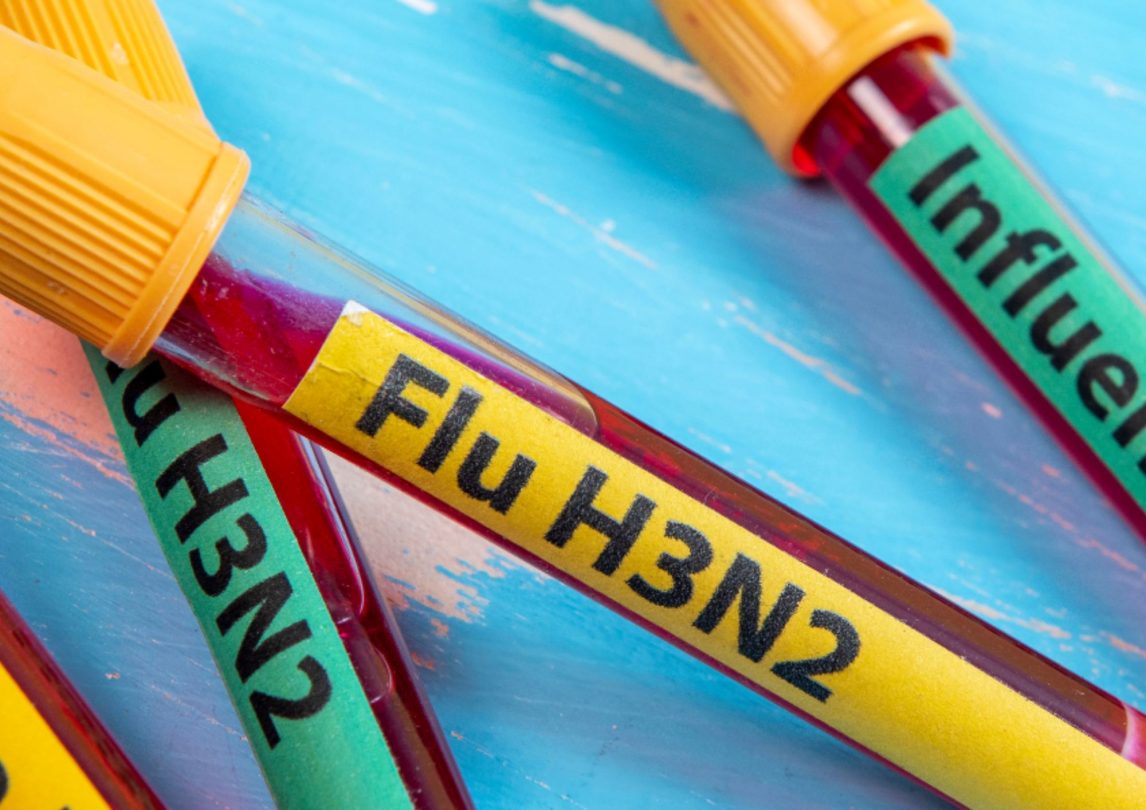 Brote de Gripe H3N2: cuándo llegaría a Argentina y cuál sería su impacto