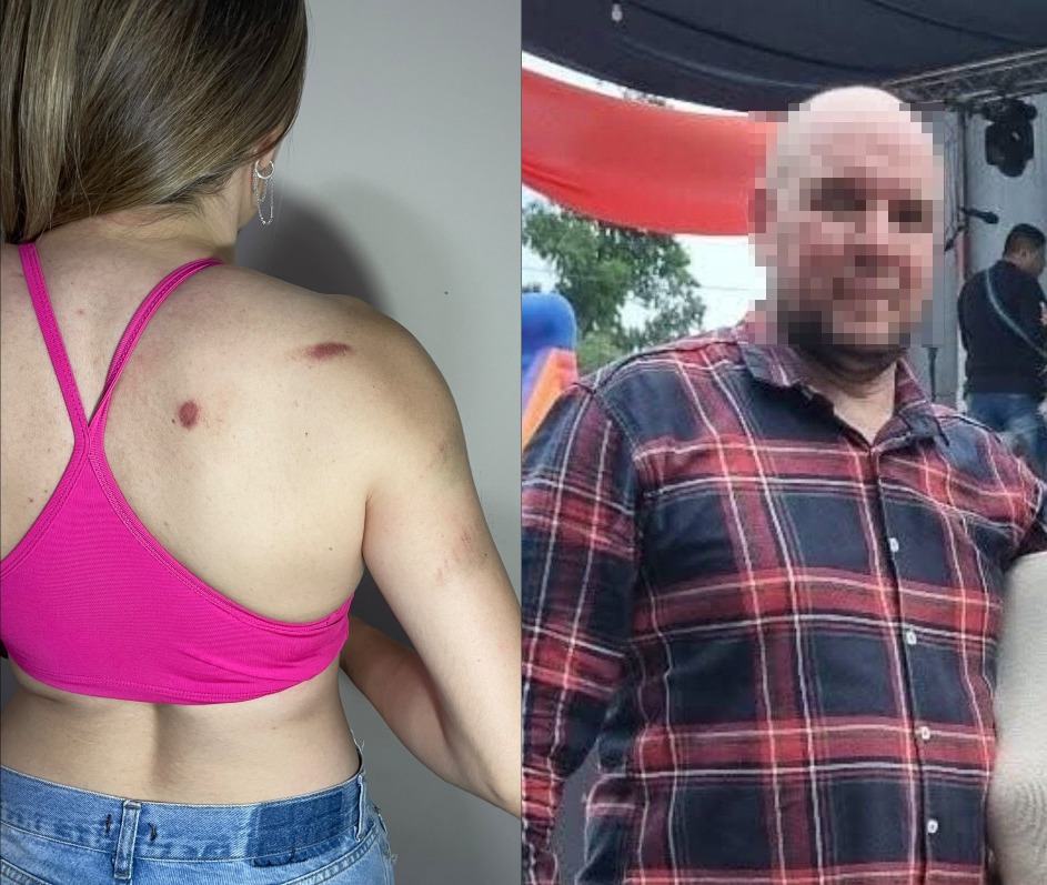  “Me agredió con golpes y trompadas delante de mis hijos”: terrible denuncia de una mamá contra su ex