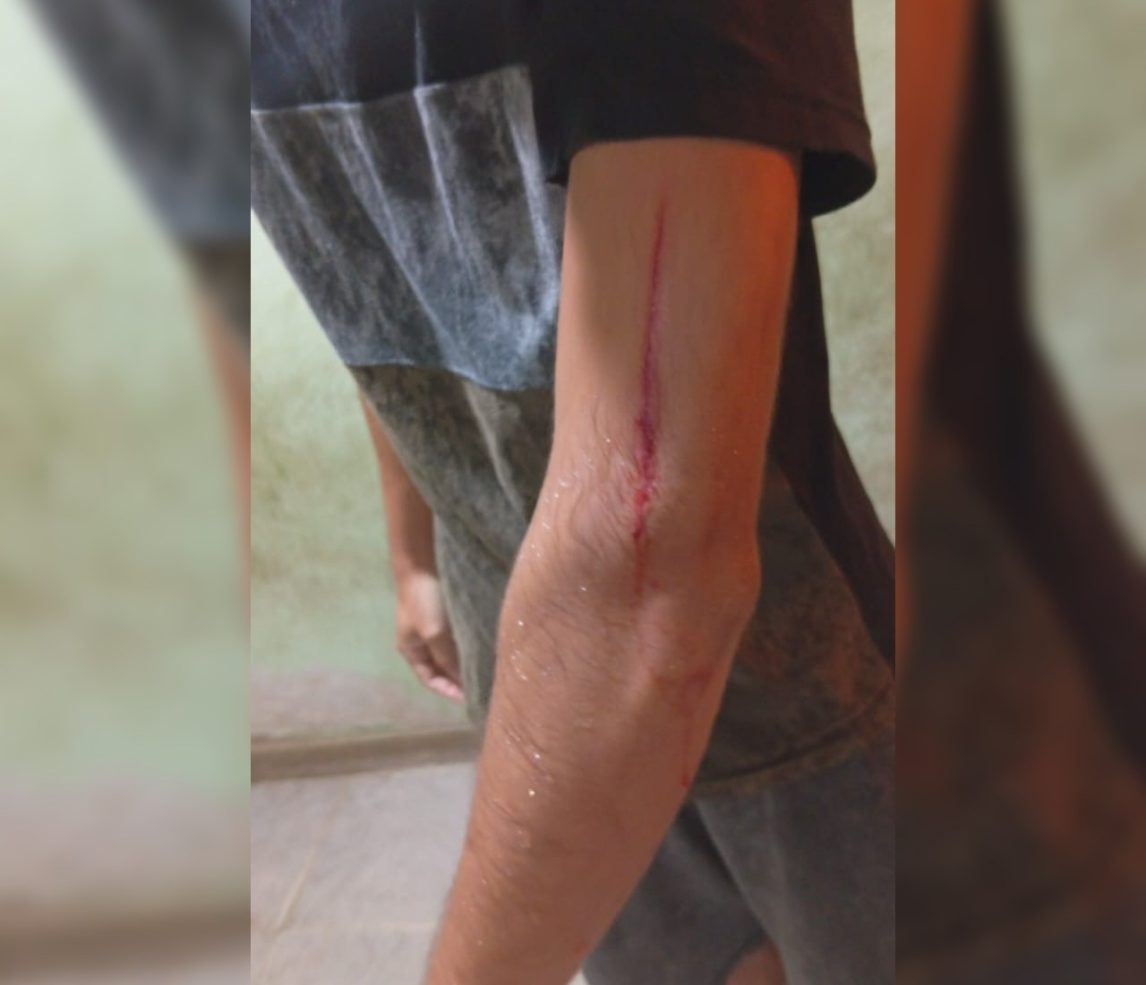 Cuatro adolescentes fueron violentamente asaltados: vecinos del B° Paraíso piden seguridad