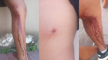 Violencia en Villa Nueva: la madre de los hermanos Castro dio su versión y negó un intento de robo