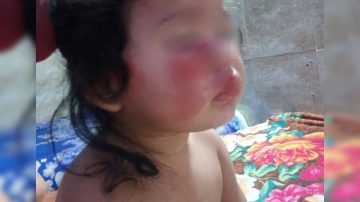 “No tienen piedad”: Una mamá mostró cómo quedó su beba luego de que las asaltaran