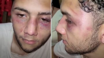 Misiones: lo golpearon con un palo y lo secuestraron para obligarlo a renunciar tras un accidente laboral