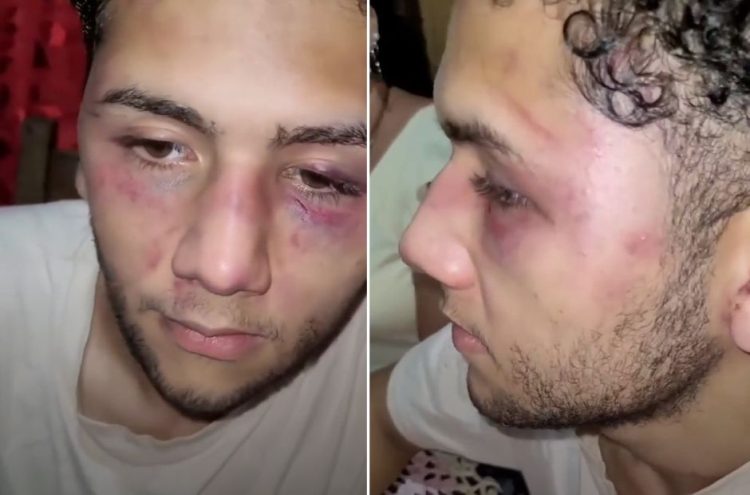 Misiones: lo golpearon con un palo y lo secuestraron para obligarlo a renunciar tras un accidente laboral