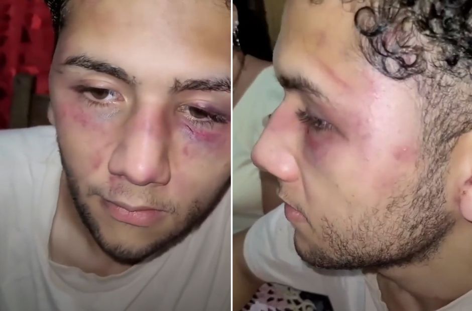 Misiones: lo golpearon con un palo y lo secuestraron para obligarlo a renunciar tras un accidente laboral