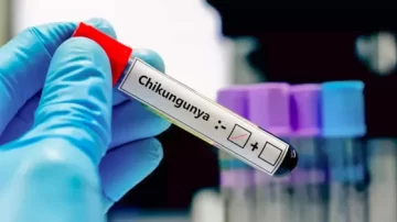 Alerta epidemiológica en el NOA: confirman el primer caso de Chikungunya en Tucumán