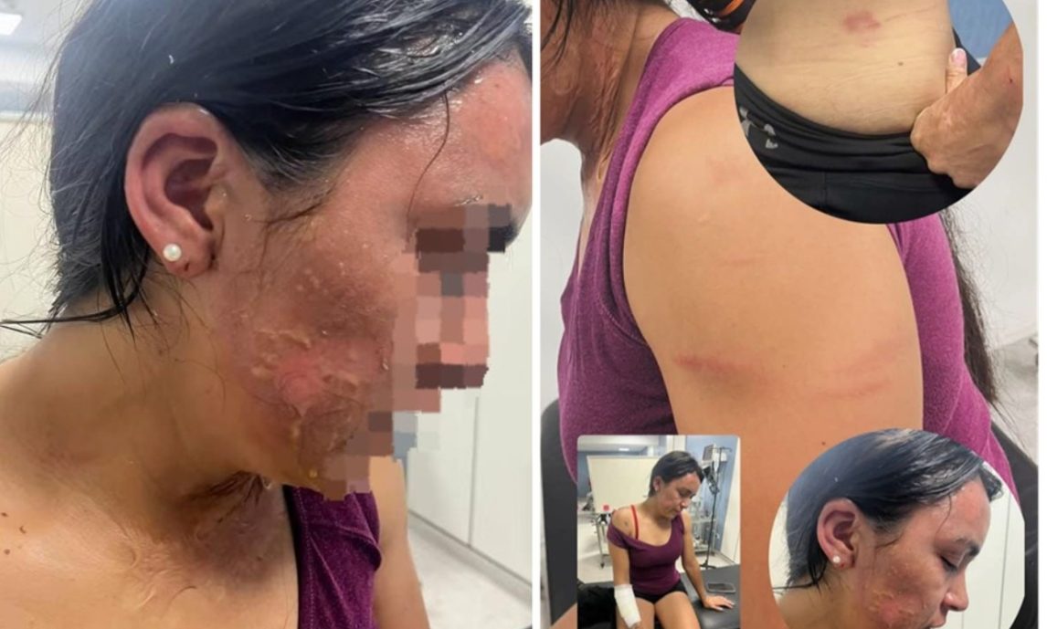 Atacaron a la hermana del influencer Jorgito Barrionuevo: la golpearon y le tiraron agua hervida