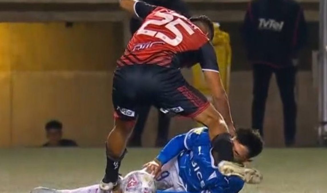 El goleador de Universidad Católica sufrió un fuerte traumatismo y quedó en duda ante Boca