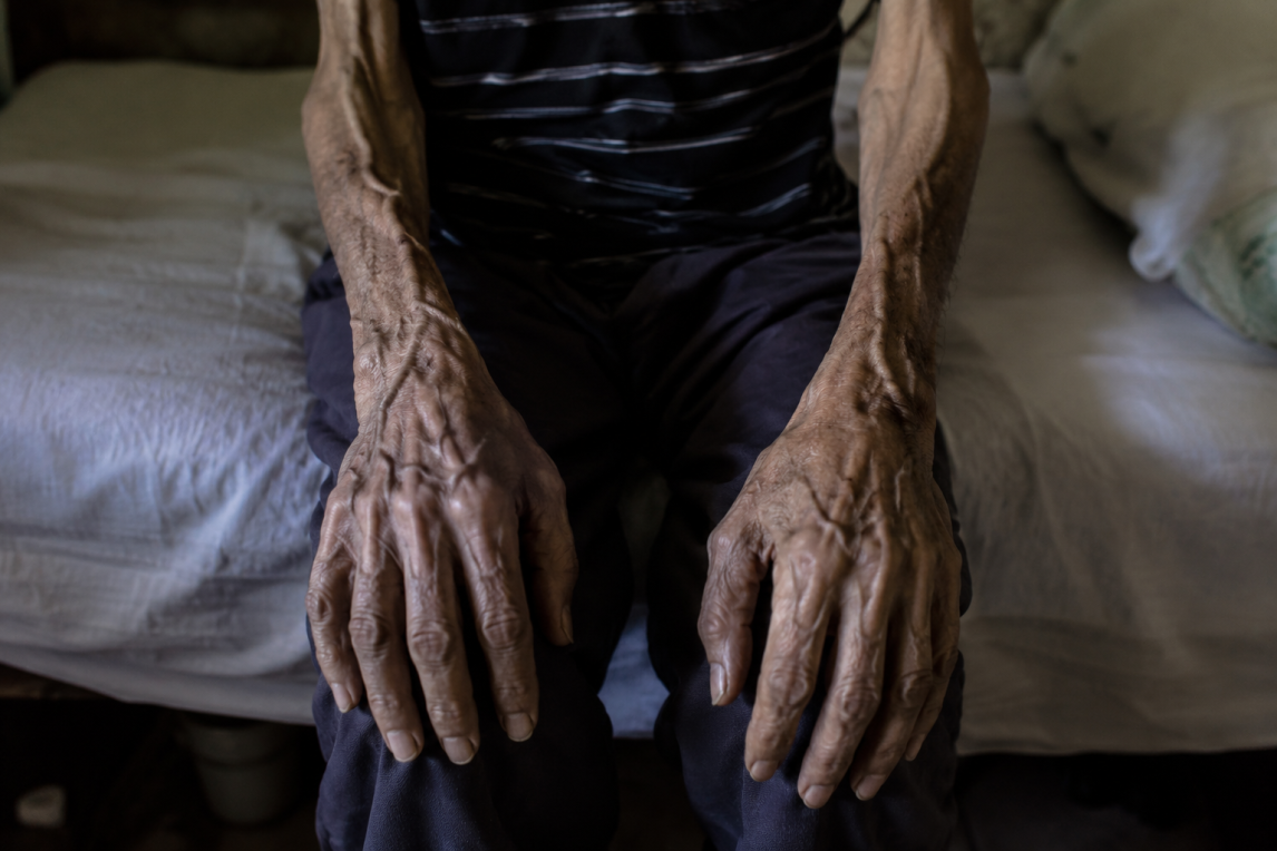Horror: un jubilado de 74 años murió desnutrido y sus últimas palabras fueron “tengo hambre”