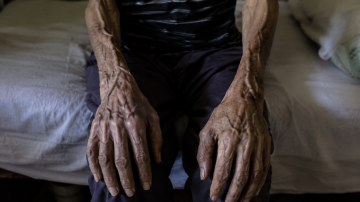 Horror: un jubilado de 74 años murió desnutrido y sus últimas palabras fueron “tengo hambre”