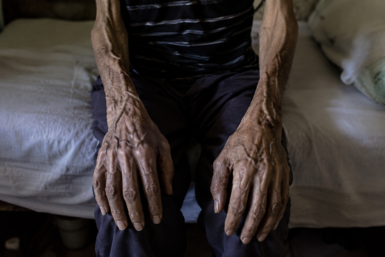 Horror: un jubilado de 74 años murió desnutrido y sus últimas palabras fueron “tengo hambre”