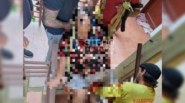 La Banda: rescatistas auxiliaron a una mujer de unos 200 kilos que no podía bajar de un tercer piso