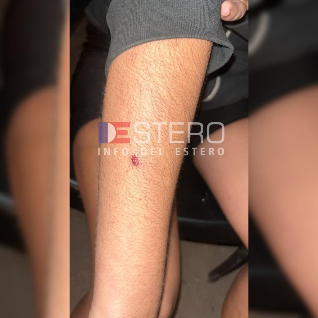 B° Santa Rosa de Lima: joven resultó herida tras disparos efectuados por el dueño de un corralón