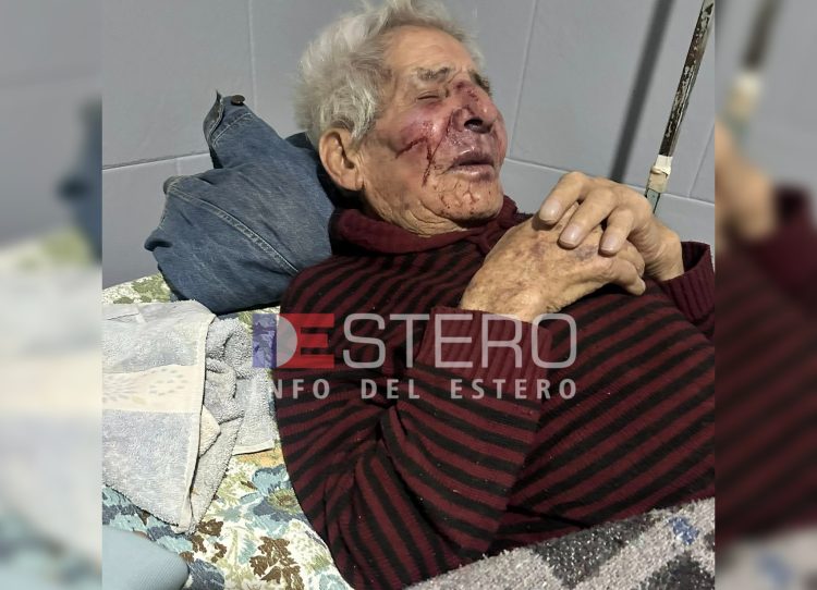 “Lo golpeó salvajemente”: termeña teme que el delincuente que atacó a su papá quede libre