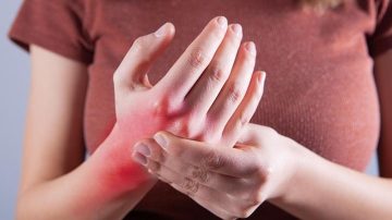 “Podemos tener lupus sin saberlo”: alertan sobre la falta de diagnóstico y visibilización de esta dolorosa enfermedad