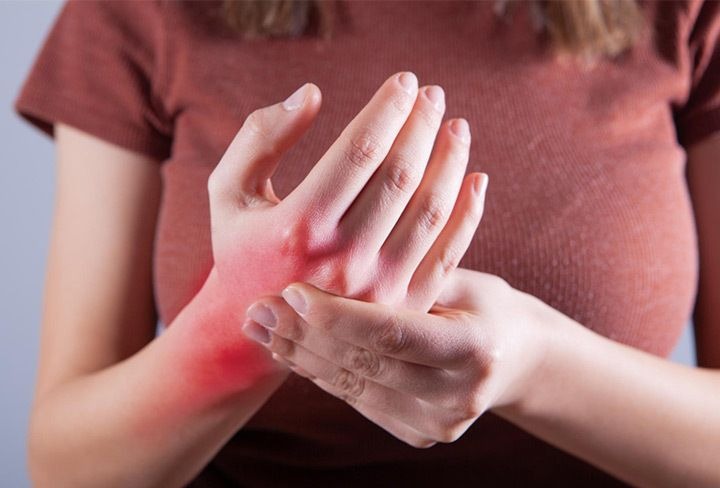 “Podemos tener lupus sin saberlo”: alertan sobre la falta de diagnóstico y visibilización de esta dolorosa enfermedad