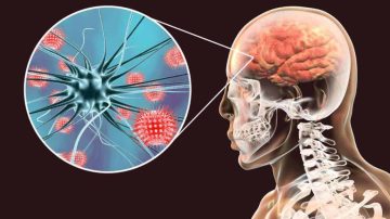 Alerta epidemiológica: los casos de meningitis superan los valores habituales en el país