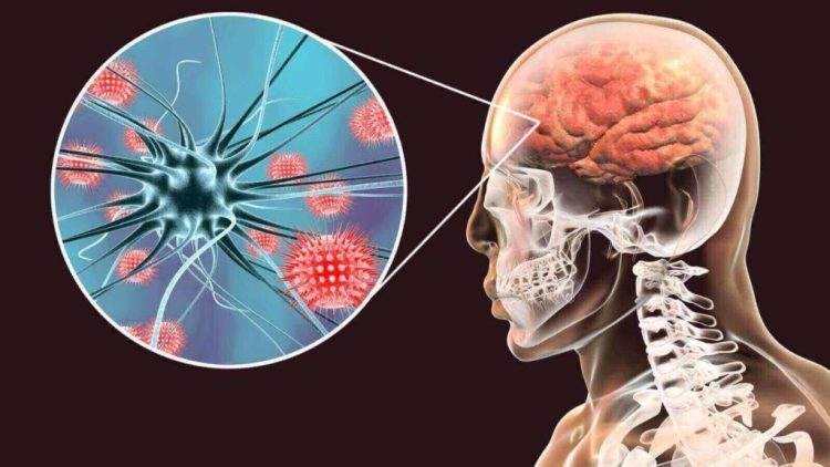 Alerta epidemiológica: los casos de meningitis superan los valores habituales en el país