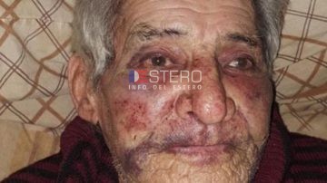 “Mi padre no quiere hablar, no quiere comer”: crítica situación del vecino termeño atacado en un robo
