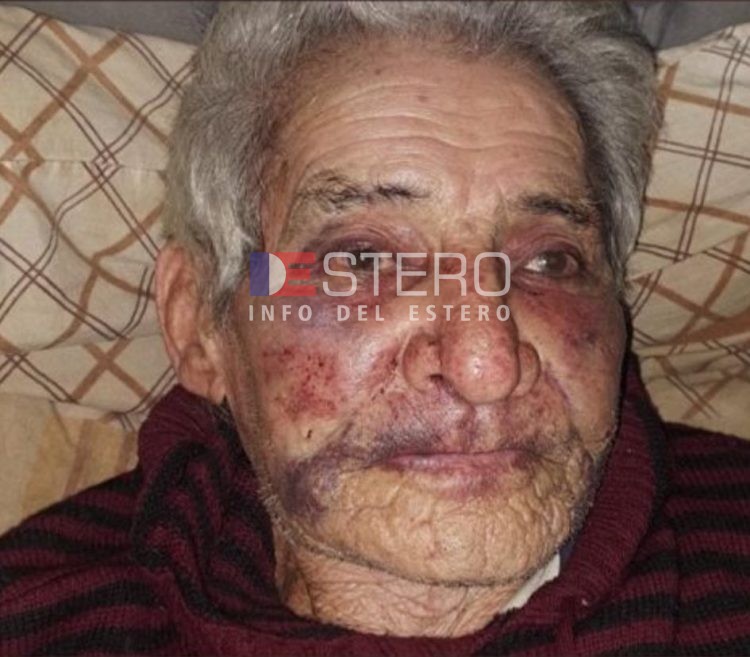 “Mi padre no quiere hablar, no quiere comer”: crítica situación del vecino termeño atacado en un robo