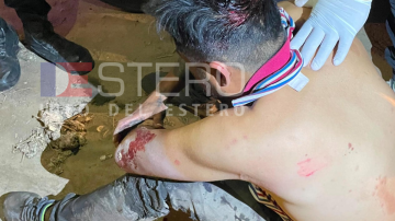 Un hombre fue atacado a machetazos en La Banda