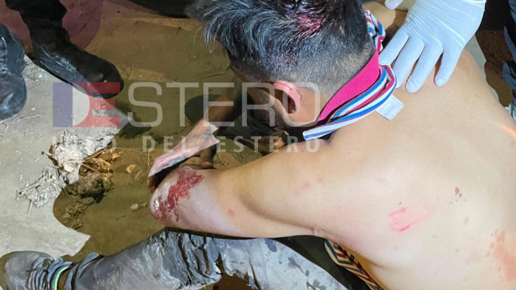 Un hombre fue atacado a machetazos en La Banda