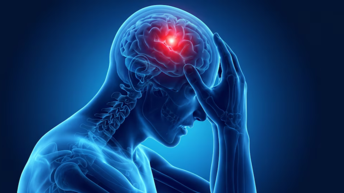 Migraña: señales ocultas que se normalizan y cuándo ir al neurólogo