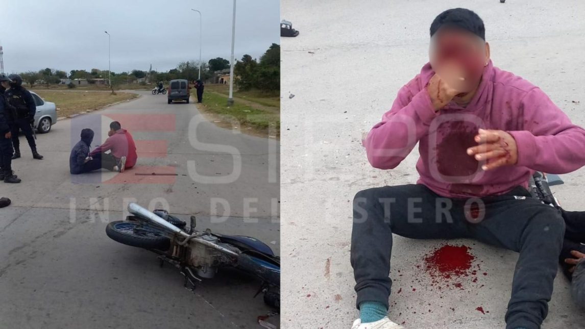 Motociclista terminó con el rostro desfigurado tras un fuerte choque en avenida Solís y Circunvalación