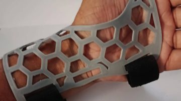 Un grupo de makers santiagueños imprimen férulas 3D para asistir a víctimas del terremoto en Venezuela