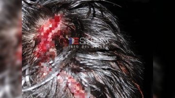 “Me rompieron la cabeza a ladrillazos por la campera”: grave asalto en el B° Campo Contreras