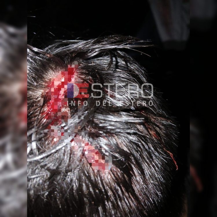 “Me rompieron la cabeza a ladrillazos por la campera”: grave asalto en el B° Campo Contreras