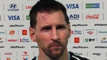El llamativo chichón de Messi tras el triunfo de Argentina ante Cabo Verde: ¿qué le pasó?
