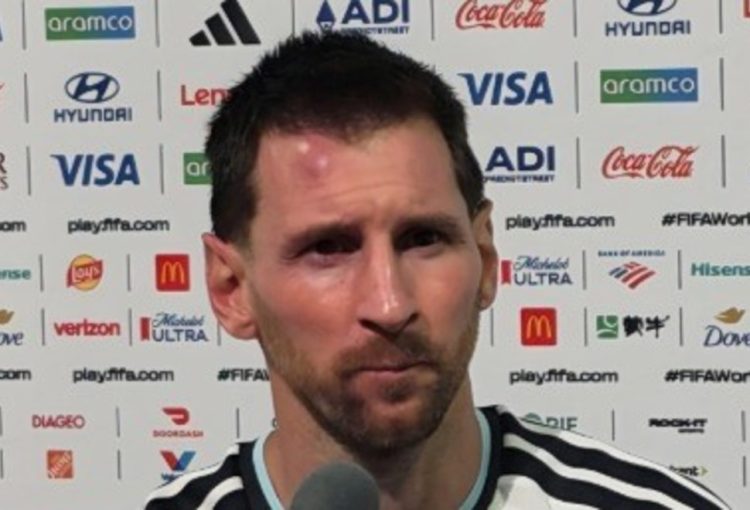 El llamativo chichón de Messi tras el triunfo de Argentina ante Cabo Verde: ¿qué le pasó?