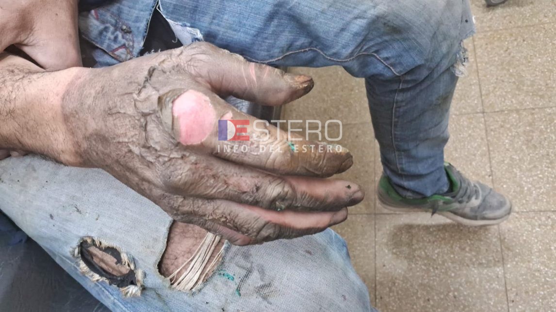 Un plomero se electrocutó al manipular un cable en una concesionaria de Ruta 51