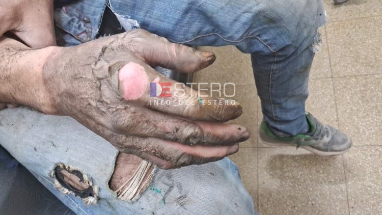 Un plomero se electrocutó al manipular un cable en una concesionaria de Ruta 51