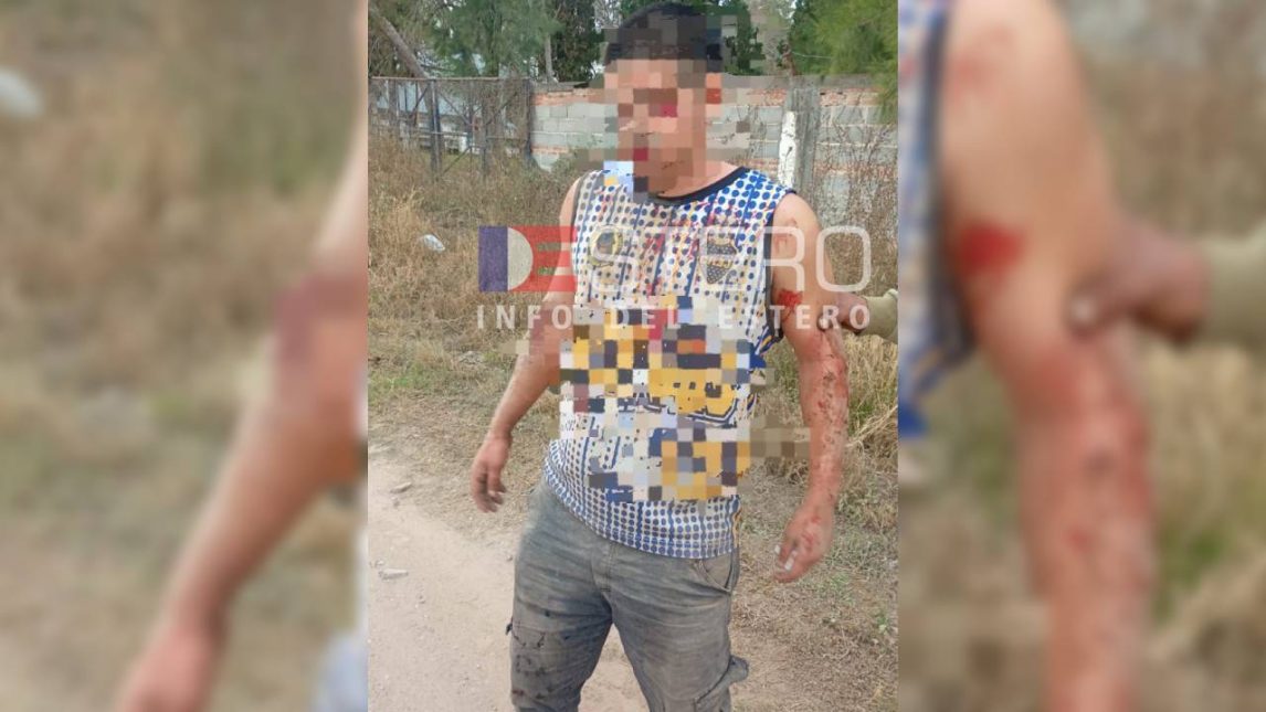 Un hincha de Atlético Frías fue herido con bala de goma: la familia denuncia a la Policía