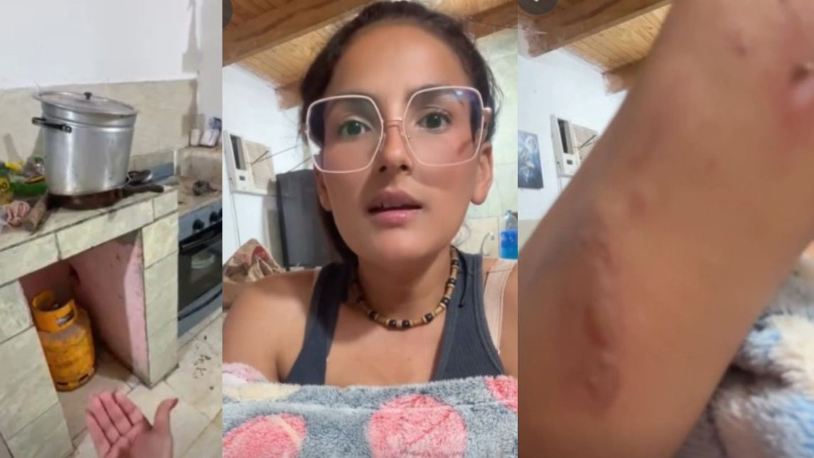 “Casi hago explotar la cocina”: el dramático relato de una influencer de La Banda tras un accidente con una garrafa