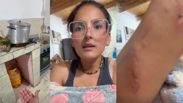 “Casi hago explotar la cocina”: el dramático relato de una influencer de La Banda tras un accidente con una garrafa